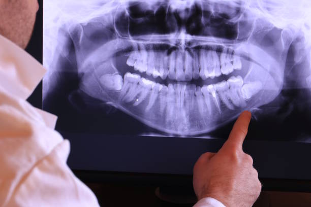Best Emergency Treatment for Jaw Pain or Injury in Shadeland, IN