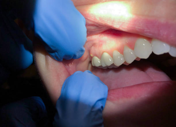Trusted IN Emergency Dental Service Experts